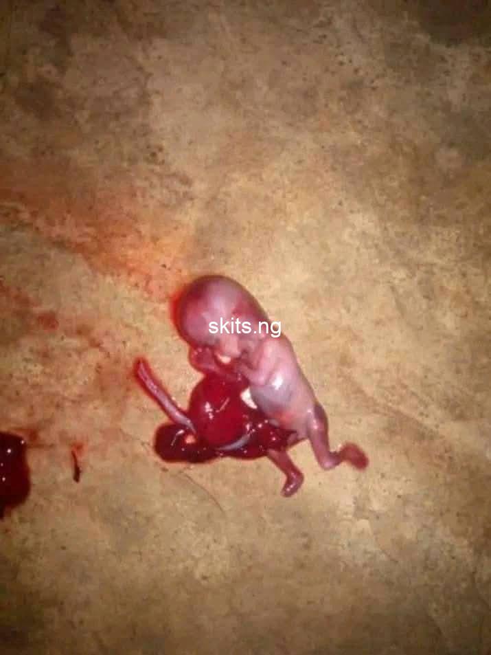 Fetus found dumped in port harcourt rivers graphic photo