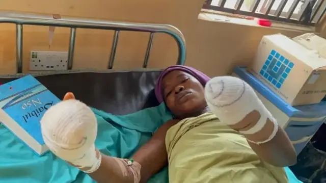 Man allegedly cuts off his wife’s hand in Enugu