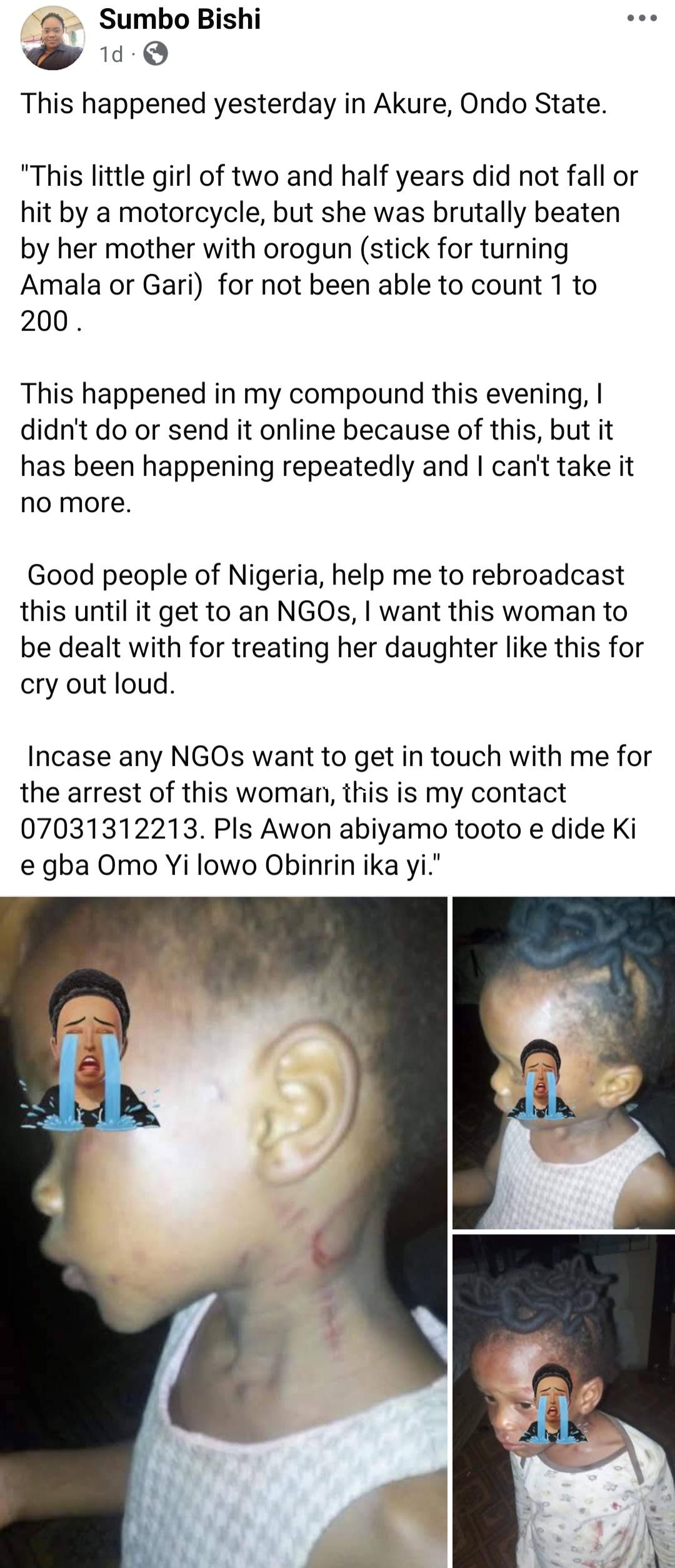 Mother allegedly beat her 2-year old brutally for not knowing how to count 1-200 in Ondo state (photos)