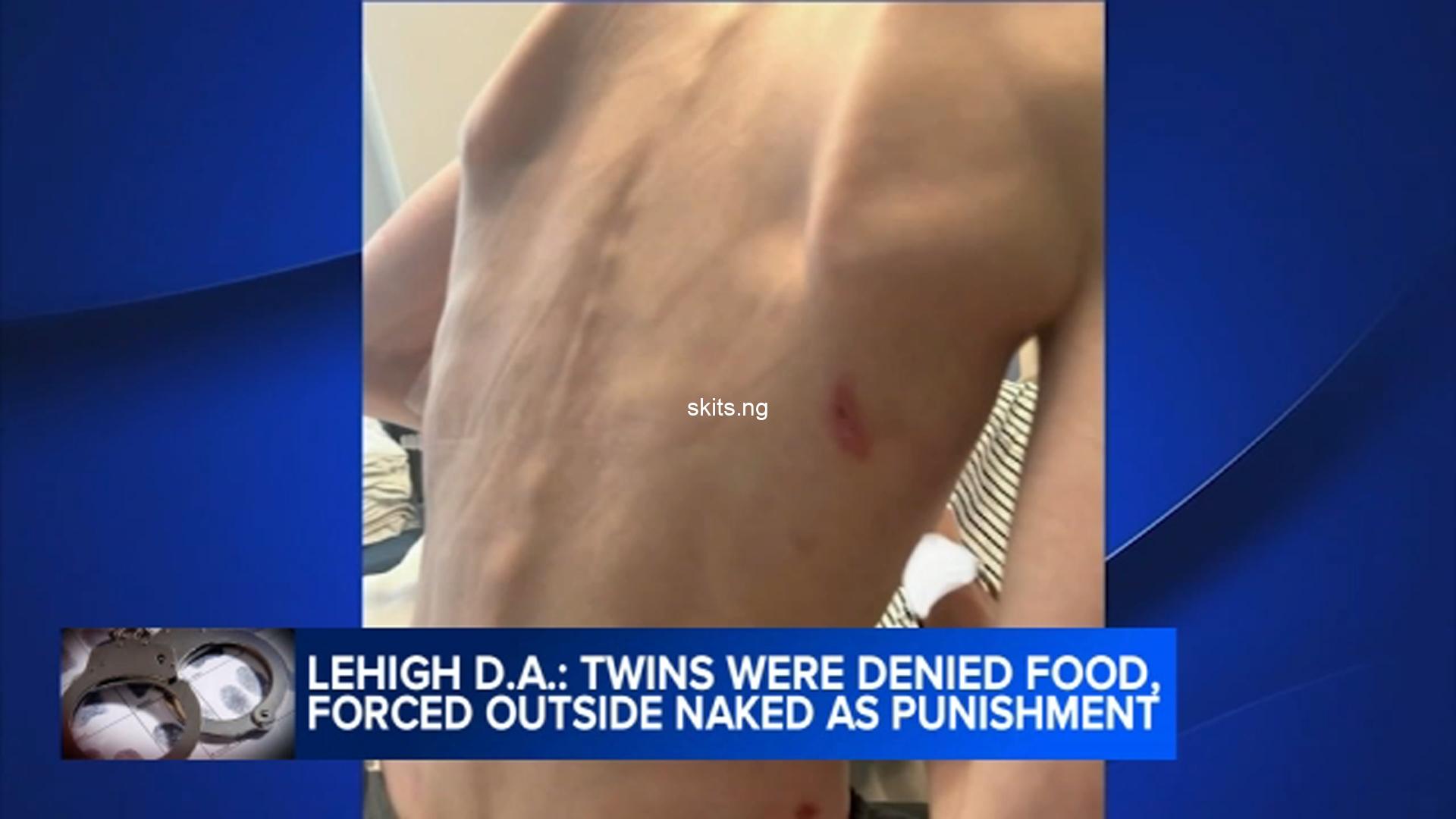 Parents charged for inflicting abuse on twin sons including forcing them to strip naked outdoors in cold