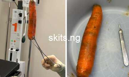 A nigerian doctor surgically removed a big carrot from a mans anus photos