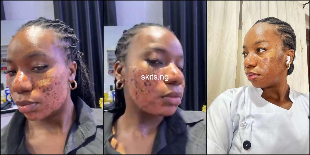 Lady permanent scar she got from aesthetic clinic following skin treatment