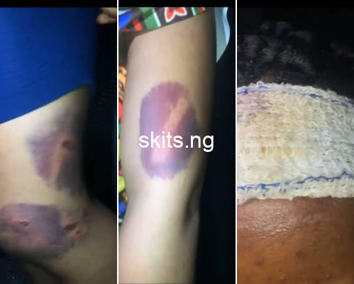 Nigerian lawyer rescues 23 year old woman allegedly brutalised by her boyfriend