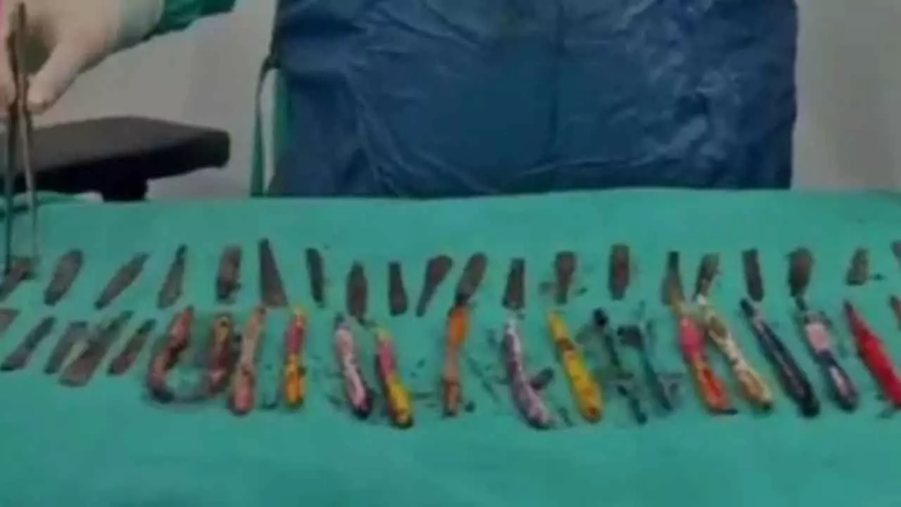 28 spoons and 19 toothbrushes found in drug addicts stomach