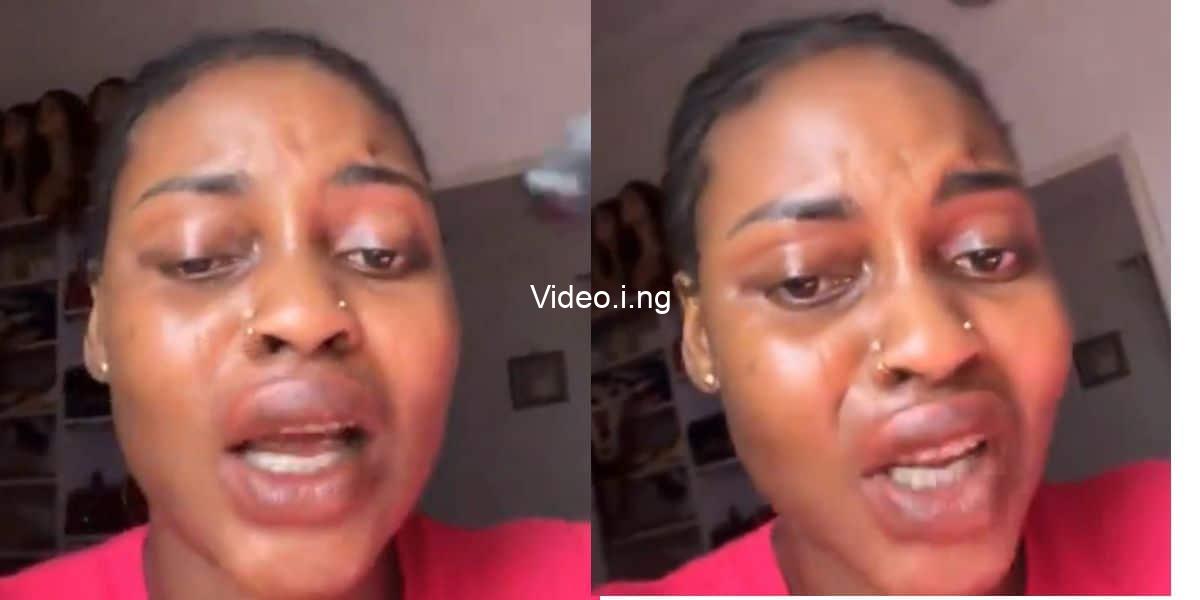 Lady cries out after attraction kayamata lip gloss gives her swollen lips