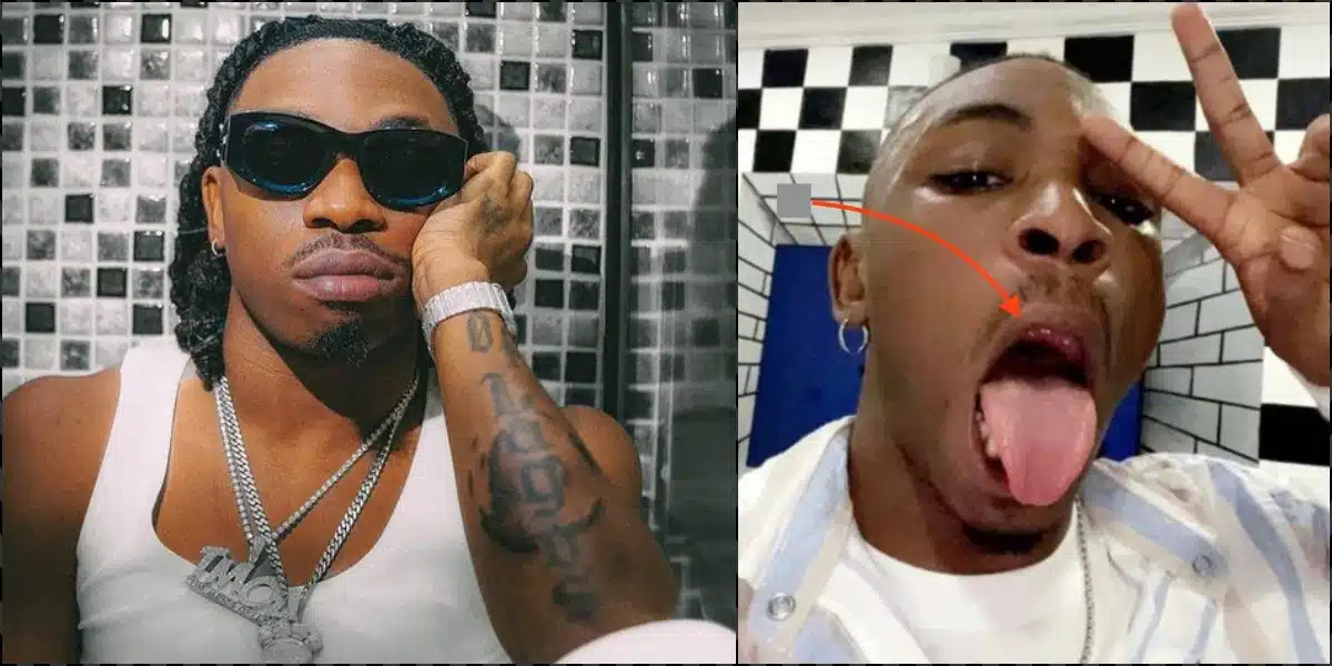 How a fan broke my tooth on stage mayorkun